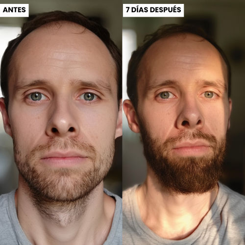 Starter Kit de Barba