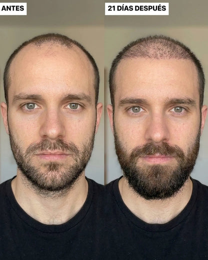 Starter Kit de Cabello y Barba