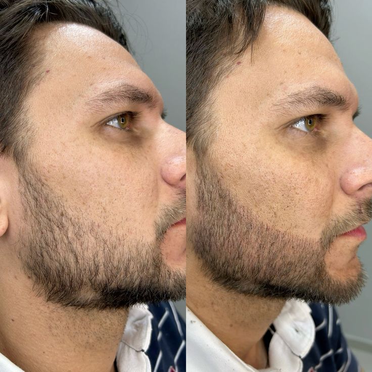 Kit de Tinte para Barba